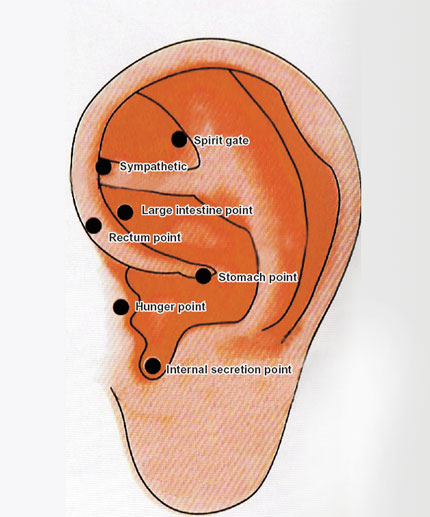 Acupuncture Points In Ear For Weight Loss